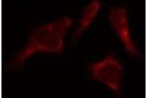 ABIN6274096 staining HepG2 by IF/ICC. (EPH Receptor B6 抗体  (Internal Region))