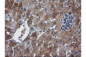 Image no. 9 for anti-Nonhomologous End-Joining Factor 1 (NHEJ1) antibody (ABIN1499728)