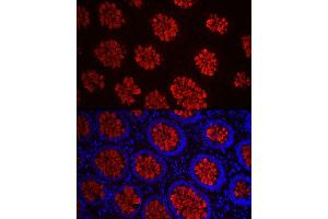 Immunofluorescence analysis of human colon carcinoma cells using MUC2 Rabbit pAb (ABIN7268690) at dilution of 1:50 (40x lens). (MUC2 抗体  (AA 4850-4950))