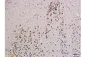 Formalin-fixed and paraffin embedded rat brain labeled with Anti-UCHL1/PGP9. (UCHL1 抗体  (AA 35-140))