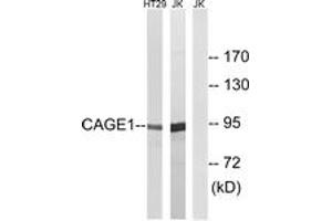 Western blot analysis of extracts from HT-29/Jurkat cells, using CAGE1 Antibody. (CAGE1 抗体  (AA 711-760))