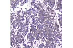 IHC analysis of RAB27A using anti-RAB27A antibody . (RAB27A 抗体  (AA 98-216))