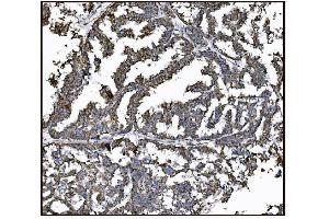 IHC analysis of FABP-1/GOT2 using anti-FABP-1/GOT2 antibody (ABIN7601426). (GOT2 抗体  (AA 35-430))