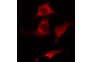 ABIN6275440 staining HuvEc cells by IF/ICC. (Radixin 抗体  (Internal Region))