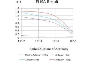 Black line: Control Antigen (100 ng),Purple line: Antigen (10 ng), Blue line: Antigen (50 ng), Red line:Antigen (100 ng) (CD5 抗体  (AA 403-495))