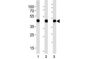 Western Blotting (WB) image for anti-Actin, alpha 1, Skeletal Muscle (ACTA1) (AA 346-375) antibody (ABIN3029835)