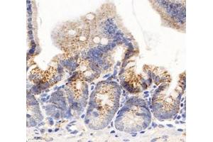 Immunohistochemistry analysis of paraffin-embedded mouse duodenum using,Arg2 (ABIN7073115) at dilution of 1: 600 (ARG2 抗体)