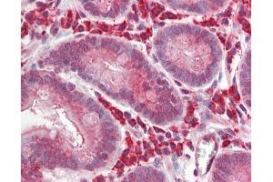 Human Small Intestine: Formalin-Fixed, Paraffin-Embedded (FFPE) (BCL3 抗体  (AA 2-13))