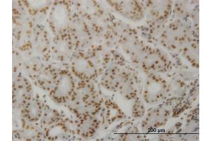 Immunoperoxidase of monoclonal antibody to PPP3CA on formalin-fixed paraffin-embedded human stomach.