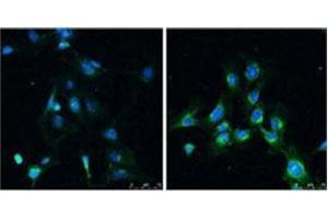 Immunofluorescence (IF) image for anti-Microtubule-Associated Protein 1 Light Chain 3 beta (MAP1LC3B) (AA 1-30), (N-Term) antibody (ABIN5555711)