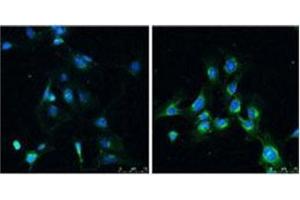 Immunofluorescence analysis of LC3B Antibody  in Rat brain before (left) and after (right) treatment with rapamycin (100 nm for 4 hr). (LC3B 抗体  (N-Term))