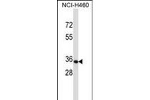 OR14C36 Antibody (C-term) (ABIN657683 and ABIN2846675) western blot analysis in NCI- cell line lysates (35 μg/lane). (OR14C36 抗体  (C-Term))