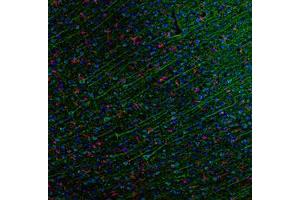 Image no. 3 for anti-Chemokine (C-C Motif) Ligand 5 (CCL5) antibody (ABIN465753) (CCL5 抗体)