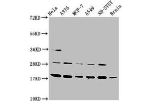 Western Blot Positive WB detected in: Hela whole cell lysate, A375 whole cell lysate, MCF-7 whole cell lysate, A549 whole cell lysate, SH-SY5Y whole cell lysate, Rat brain tissue All lanes: DAZAP2 antibody at 3. (DAZAP2 抗体  (AA 1-168))