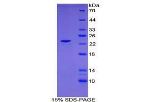 SDS-PAGE analysis of Human CLEC10A Protein. (CLEC10A 蛋白)
