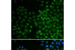 Immunofluorescence analysis of U2OS cells using NR0B2 Polyclonal Antibody (NR0B2 抗体)
