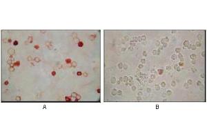 Immunocytochemistry analysis of TPA induced BCBL-1 cells (A) and uninduced BCBL-1 cells (B) using KSHV ORF62 mouse mAb with AEC staining. (KSHVORF62 抗体)
