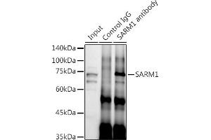 Immunoprecipitation analysis of 300 μg extracts of SH-SY5Y cells using 3 μg S antibody (ABIN7270591). (SARM1 抗体)