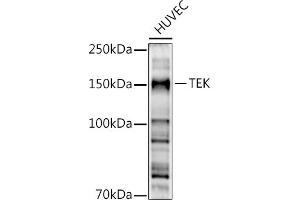 Western blot analysis of extracts of HUVEC cells, using TEK antibody (ABIN6127575, ABIN6148992, ABIN6148994 and ABIN6213973) at 1:500 dilution. (TEK 抗体  (AA 500-750))