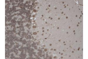 Immunohistochemistry (IHC) image for anti-Transient Receptor Potential Cation Channel, Subfamily M, Member 7 (TRPM7) (AA 1817-1863) antibody (ABIN361775)