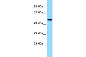 WB Suggested Anti-CLNK Antibody Titration: 1. (CLNK 抗体  (C-Term))