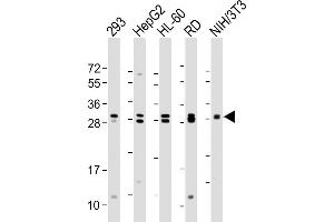 All lanes : Anti-EIF4E2 Antibody at 1:2000 dilution Lane 1: 293 whole cell lysate Lane 2: HepG2 whole cell lysate Lane 3: HL-60 whole cell lysate Lane 4: RD whole cell lysate Lane 5: NIH/3T3 whole cell lysate Lysates/proteins at 20 μg per lane. (EIF4E2 抗体)