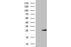 Western Blotting (WB) image for anti-ATP-Binding Cassette, Sub-Family C (CFTR/MRP), Member 5 (ABCC5) antibody (ABIN2715613) (ABCC5 抗体)