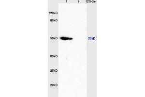 Lane 1: mouse brain lysates Lane 2: mouse lung lysates probed with Anti Caspase-9 p10 Polyclonal Antibody, Unconjugated (ABIN1387603) at 1:200 in 4 °C. (Caspase 9 抗体  (AA 351-416))