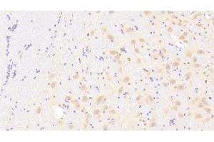 Immunohistochemistry (IHC) image for anti-Chemokine (C-X-C Motif) Ligand 1 (Melanoma Growth Stimulating Activity, Alpha) (CXCL1) (AA 35-107) antibody (ABIN7430522)