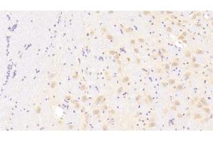 Detection of CXCL1 in Human Cerebrum Tissue using Polyclonal Antibody to Chemokine (C-X-C Motif) Ligand 1 (CXCL1) (CXCL1 抗体  (AA 35-107))