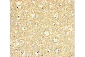 Immunohistochemistry of paraffin-embedded human brain tissue using ABIN7174125 at dilution of 1:100 (SIRPA 抗体  (AA 31-373))