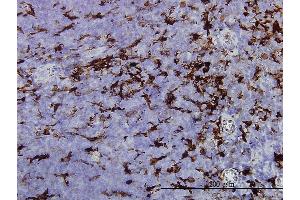 Immunoperoxidase of monoclonal antibody to GSN on formalin-fixed paraffin-embedded human tonsil. (Gelsolin 抗体  (AA 673-782))