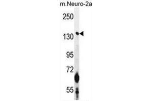 Western Blotting (WB) image for anti-Calmodulin Regulated Spectrin Associated Protein 1 (CAMSAP1) (AA 41-70), (N-Term) antibody (ABIN951018)