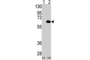 Western blot analysis of AMFR (arrow) using AMFR polyclonal antibody . (AMFR 抗体  (AA 571-601))