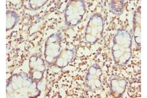 Immunohistochemistry of paraffin-embedded human small intestine tissue using ABIN7154604 at dilution of 1:100 (SAR1A 抗体  (AA 1-198))