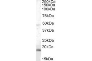Western Blotting (WB) image for anti-Brain and Acute Leukemia, Cytoplasmic (BAALC) (AA 136-150) antibody (ABIN296188)