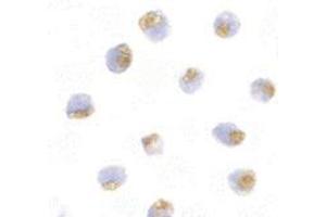 Immunocytochemistry of TLR1 in Daudi with this product at 10 μg/ml. (TLR1 抗体  (Center))