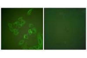 Immunofluorescence analysis of A549 cells, using Synuclein β antibody. (beta Synuclein 抗体)