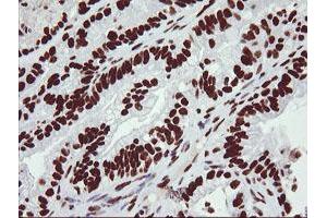 Image no. 6 for anti-Non-POU Domain Containing, Octamer-Binding (NONO) (AA 184-385) antibody (ABIN1491072)