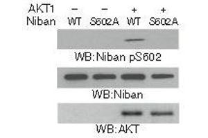 Western blot analysis in vitro kinase assays were performed by mixing purified bacterially expressed WT His-Niban or the His-Niban S602A with or without purified active AKT1 using Niban (Phospho-Ser602) Antibody.