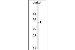 SELPLG Antibody (C-term) (ABIN654425 and ABIN2844160) western blot analysis in Jurkat cell line lysates (35 μg/lane).
