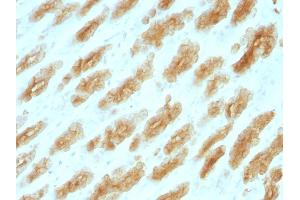 Immunohistochemistry (IHC) image for anti-Cytokeratin-2P (KRT76) antibody (ABIN6941449)
