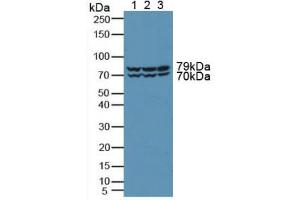 Figure. (PKD2 抗体  (AA 621-832))