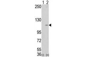 Western blot analysis of LSD1 antibody and 293 cell lysate (2 ug/lane) either nontransfected (Lane 1) or transiently transfected with the AOF2 gene (2). (LSD1 抗体  (AA 457-490))