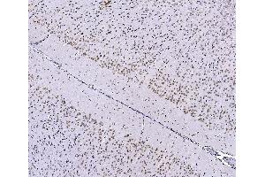 IHC analysis of FOXK1 using anti-FOXK1 antibody (ABIN7600295).