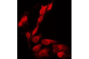 ABIN6266703 staining HeLa by IF/ICC. (PHF1 抗体  (Internal Region))