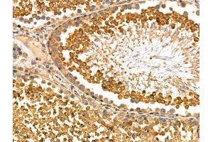 ABIN6259183 and ABIN6275173 at 1/100 staining Rat testis tissue by IHC-P. (SAR1B 抗体  (Internal Region))