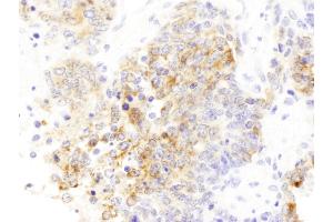 Immunohistochemistry (IHC) image for anti-Drebrin 1 (DBN1) (AA 599-649) antibody (ABIN7453432) (DBN1 抗体  (AA 599-649))