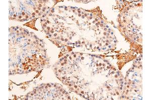 ABIN6267073 at 1/100 staining mouse testicular tissue sections by IHC-P. (CHEK1 抗体  (pSer280))