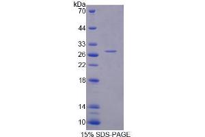 SDS-PAGE analysis of Human RFC5 Protein. (RFC5 蛋白)